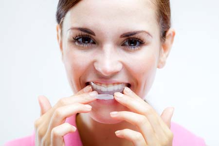 Here Are The Two Main Groups That Use Invisalign® To Straighten Teeth In St George