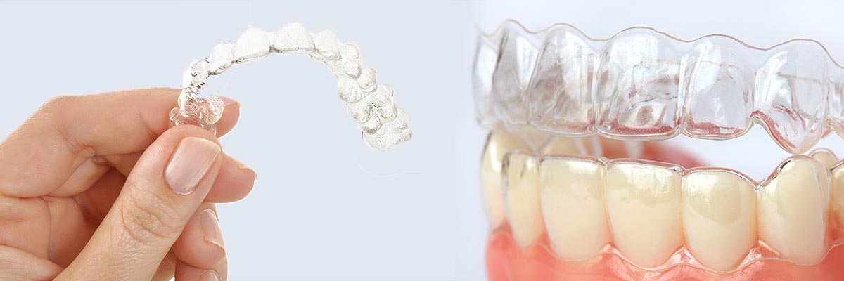 St George Alternative to Braces for Teens