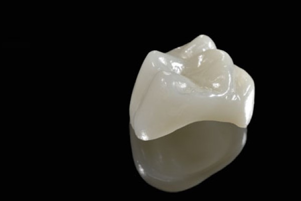 CEREC Dentist St George, UT