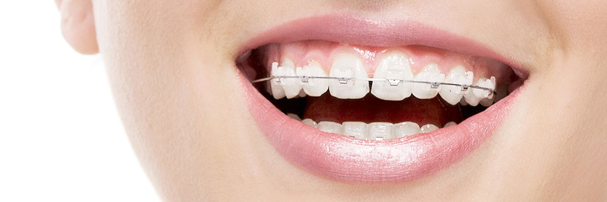 St George Invisible Orthodontics