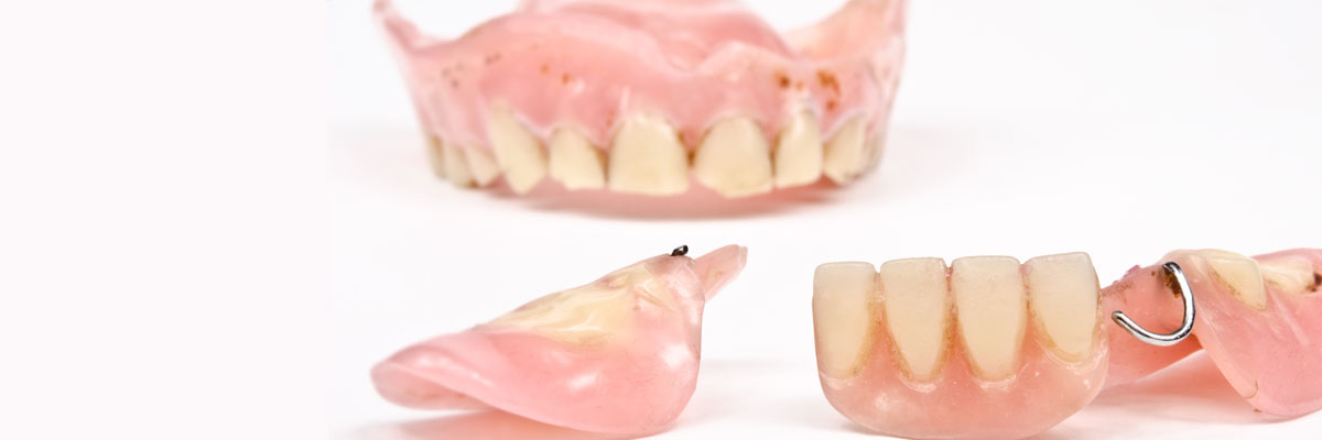 St George What Do I Do If I Damage My Dentures?