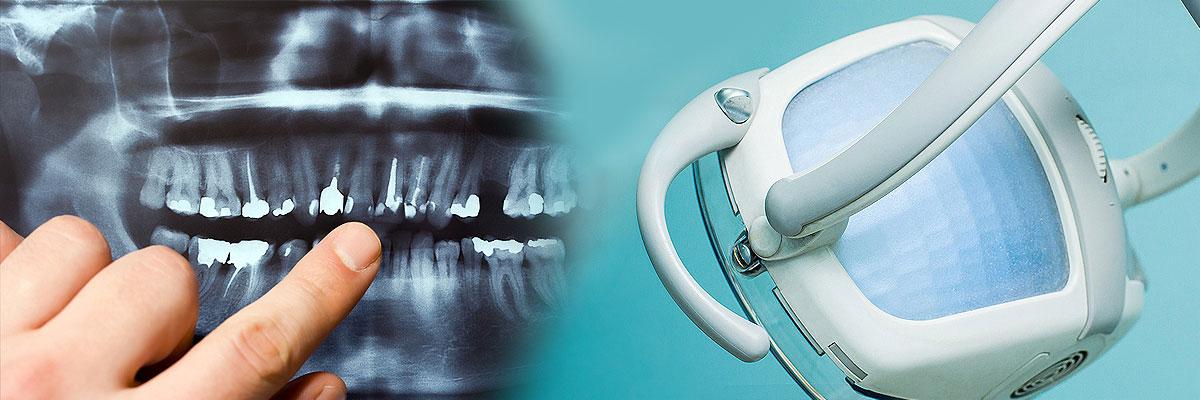 St George Dental Cleaning