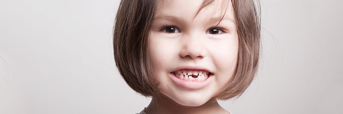 St George Dental Restoration