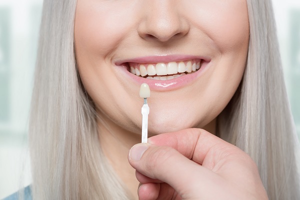 Dental Veneers and Dental Laminates St George, UT