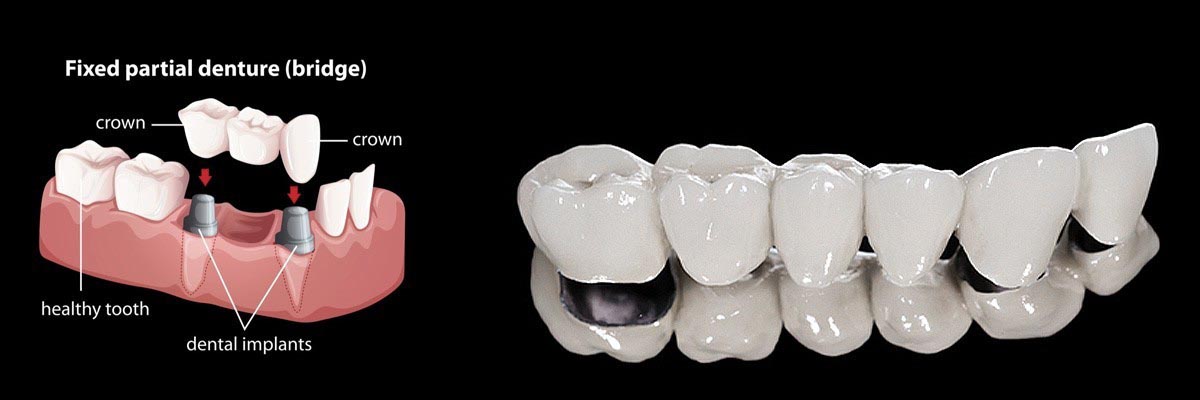 St George Dentures