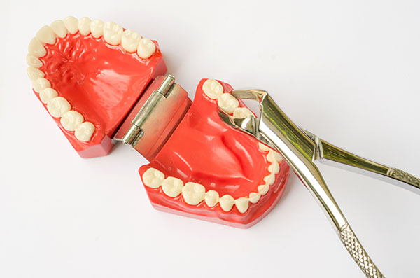 Tooth extraction St George, UT