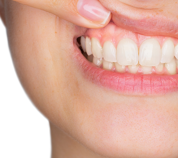 Gum Disease St George, UT