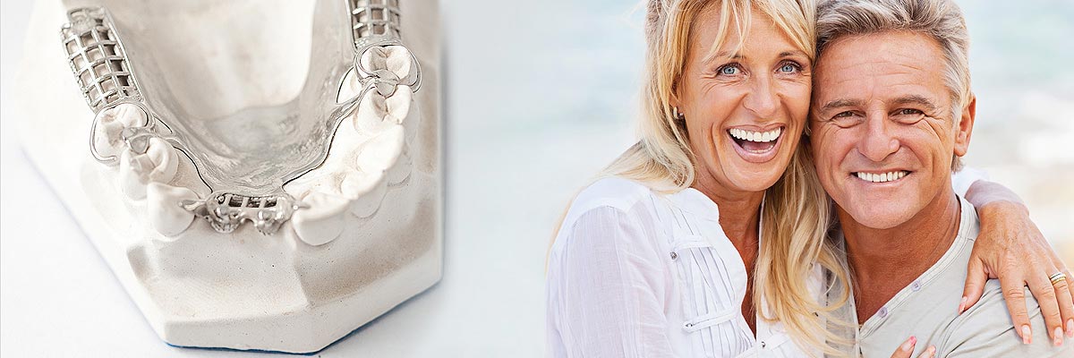 St George Implant Supported Dentures
