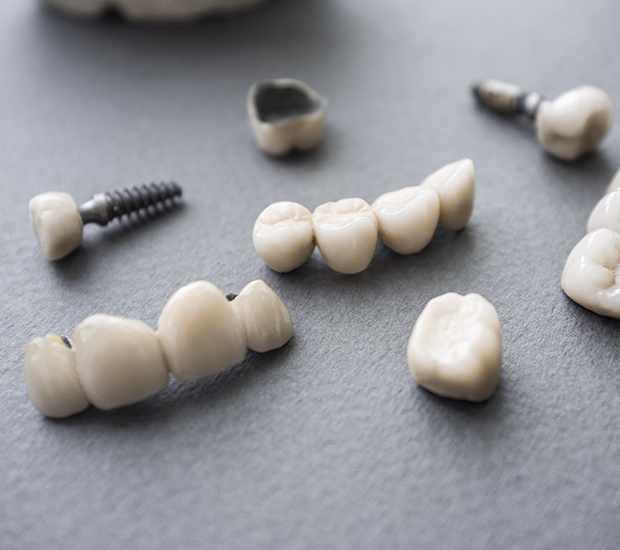 The Difference Between Dental Implants and Mini Dental Implants