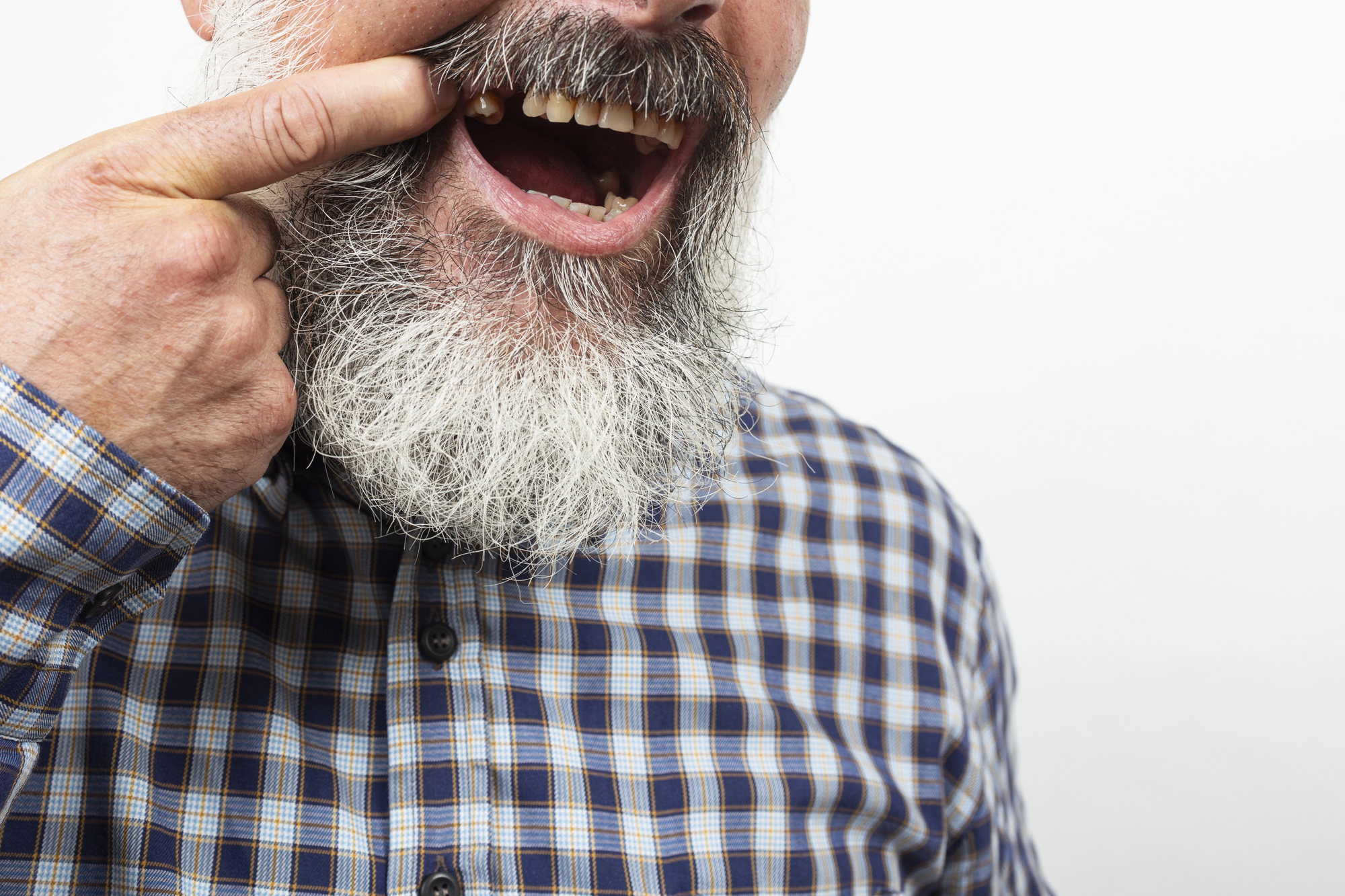 What Is A Missing Tooth Clause? How It Affects Your Dental Insurance