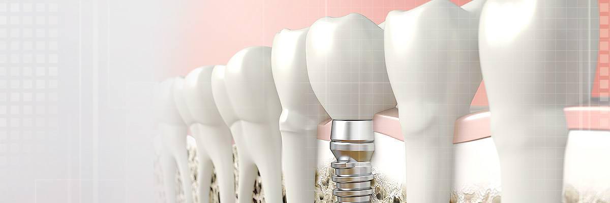 St George Periodontics