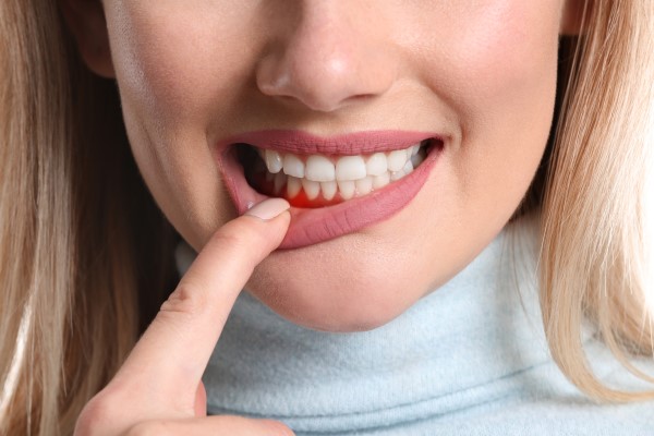 The Importance Of Oral Hygiene For Preventive Dentistry