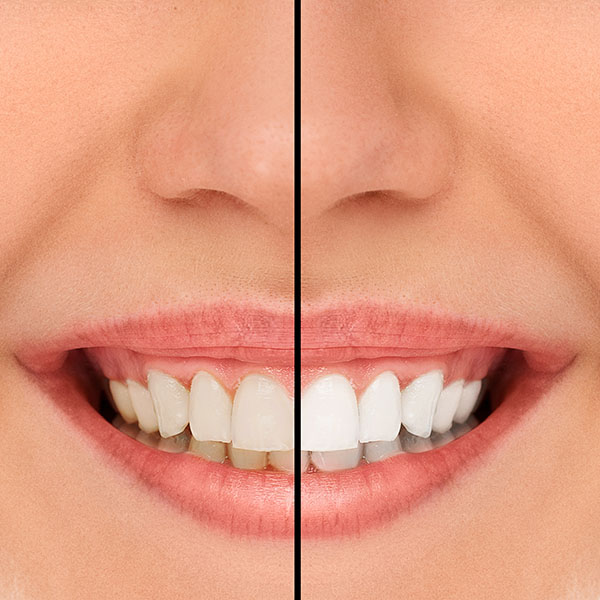 Ask A Dentist: Can I Make My Teeth Healthy Again?