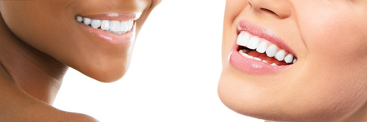 St George Teeth Whitening