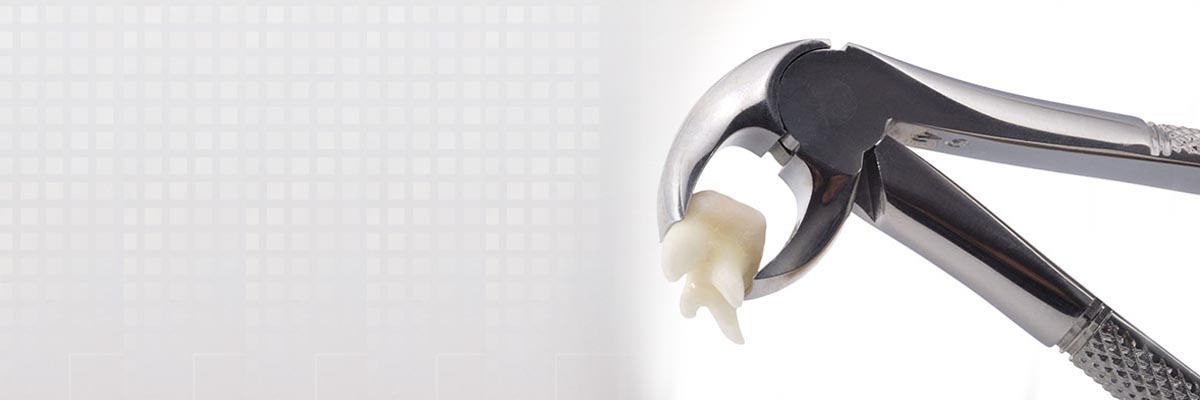 St George Tooth Extraction